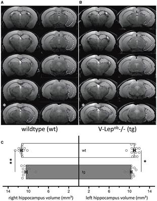 Changes in hippocampal volume, synaptic plasticity and amylin sensitivity in an animal model of type 2 diabetes are associated with increased vulnerability to amyloid-beta in advancing age